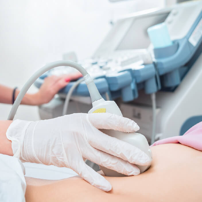 超音波画像診断装置（エコー）